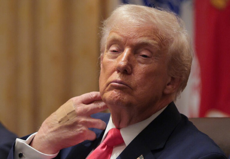 Prerogative Powers and Presidential Self Care